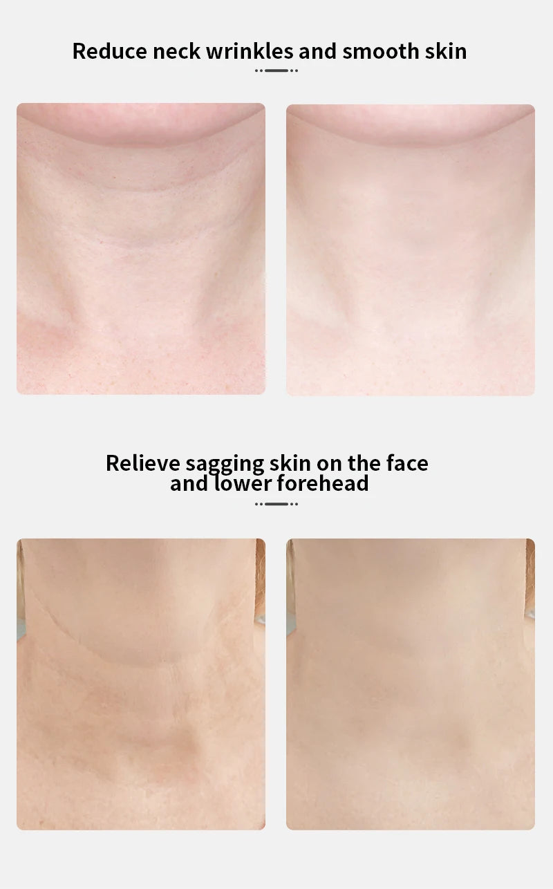 ANLAN Neck & Face Lifting Device – Tighten & Glow