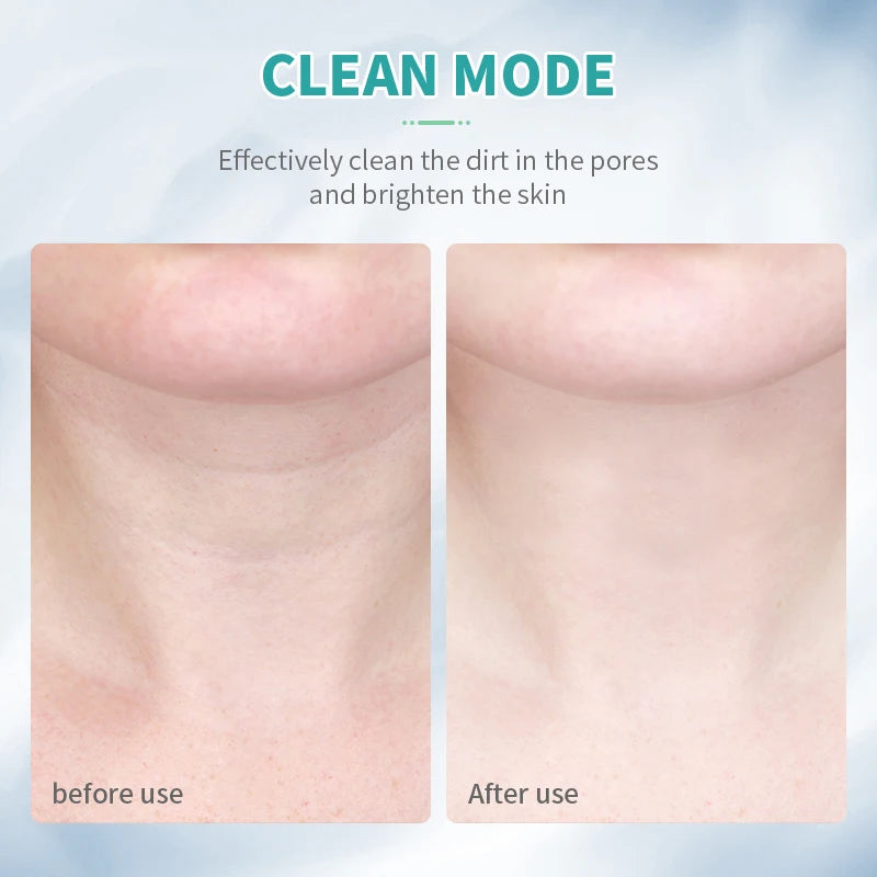 ANLAN Neck & Face Lifting Device – Tighten & Glow