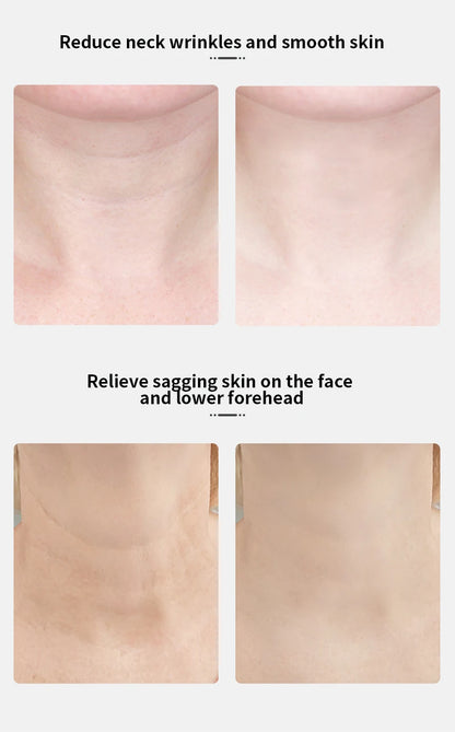 ANLAN Neck & Face Lifting Device – Tighten & Glow