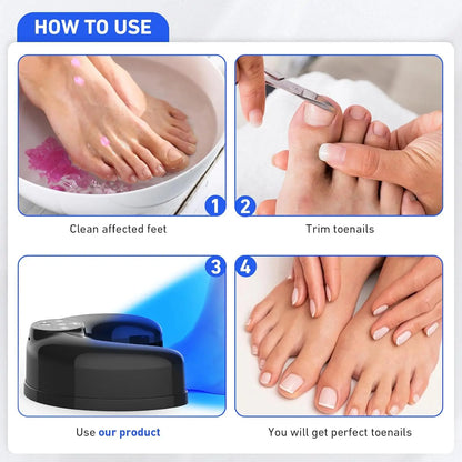 Wireless, Nail Fungus, Laser Device, Infrared, Blue Light, Anti-Fungal
