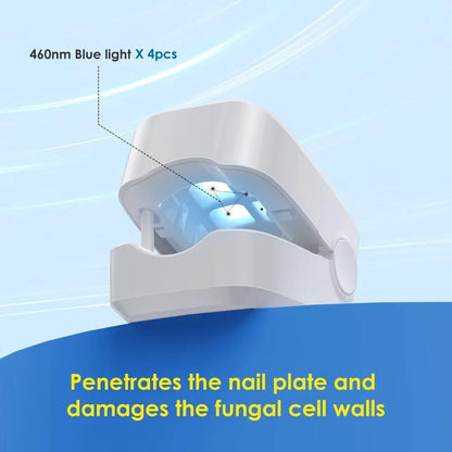 Nail Fungus Laser Assist Tool UV Professional Nail Fungus