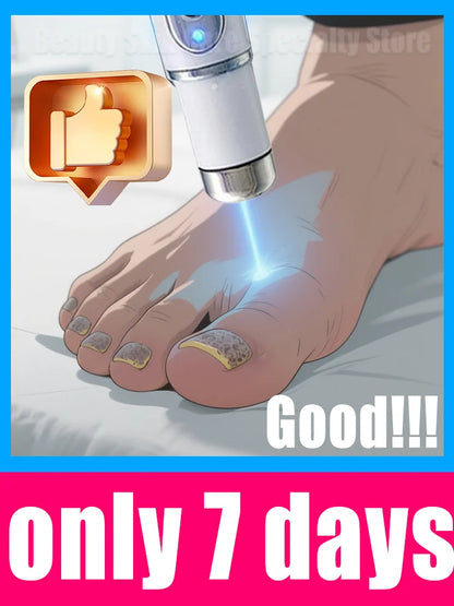 Blue Light Nail Cleaning Laser Tools Root Repair